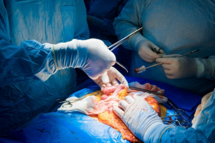 Gastrointestinal Surgery